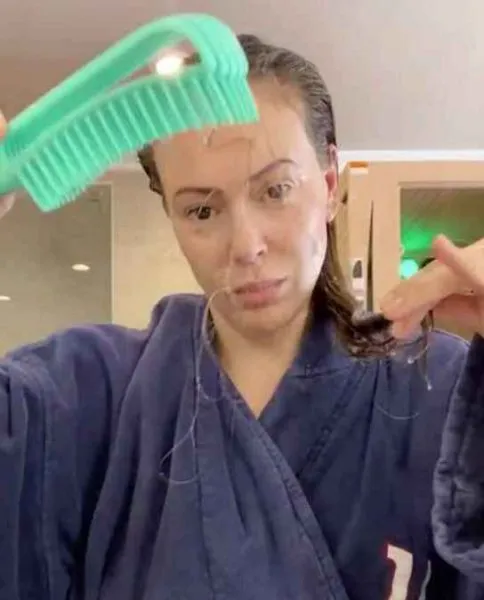 Alyssa Milano Pérdida De Cabello
